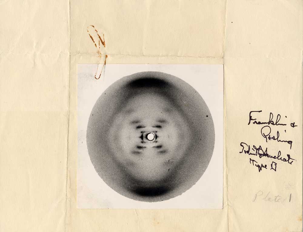 Fotografría de los Rayos X del ADN por Rosalind Franklin