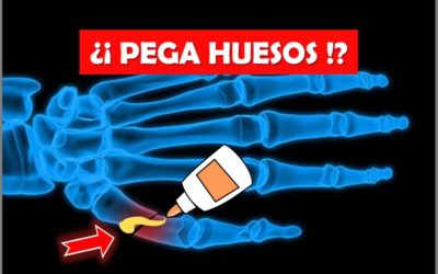 ¿El PEGAMENTO para huesos? Tetranite® Un BIOMATERIAL capaz REPARAR huesos fracturados, fosfoserina q es fosfoserina que es hidroxiapatita cálcica hidroxiapatita cálcica formula acido lactico bacterias boca los huesos del cuerpo humano de que estan hechos reparacion del tejido oseo, Pegamento para huesos launchpad medical tetranite bone glue tetranite bone adhesive pegamento de huesos pegamento para pegar metal tetranite bone glue tetranite bone cement fosfoserina para que sirve relleno de hidroxiapatita cálcica reparar huesos rotos como pegar huesos rotos como reparar un hueso fracturado De qué están hechos los huesos de qué están hechos los huesos humanos de que estan hechos los huesos del ser humano huesos del cuerpo humano